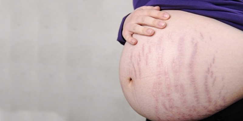 روغن برای جلوگیری از ایجاد ترک های پوست