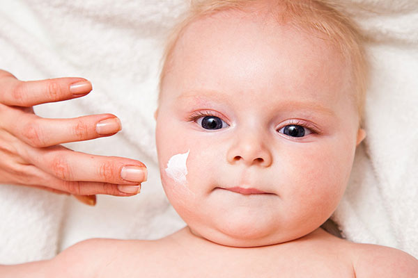 درمان عرق سوز شدن نوزاد