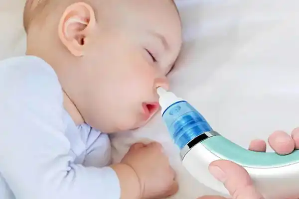 پوار بینی برقی نوزاد