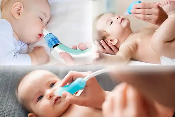 پوار بینی برقی نوزاد