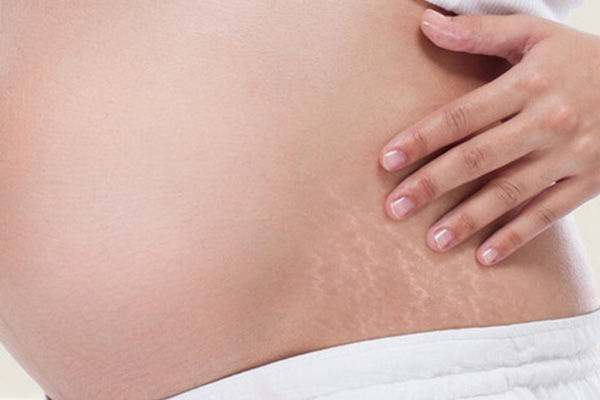 بهترین زمان استفاده از کرم ترک در بارداری چه موقع است؟