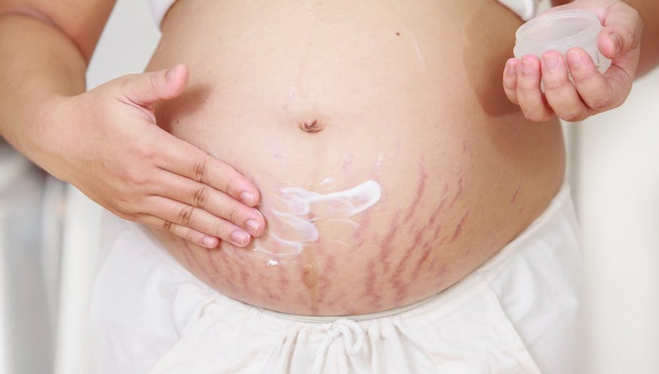 مراقبت از پوست در دوران بارداری