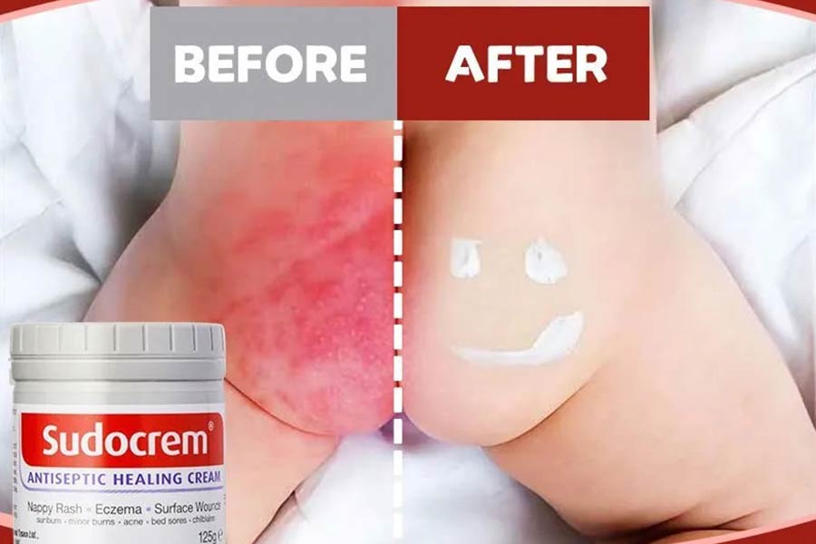 مزایا و معایب استفاده سودوکرم